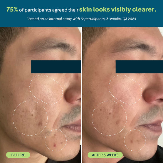 Anti-Everything Face Serum